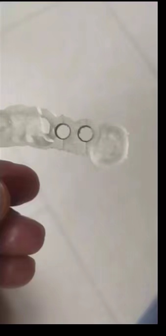 Resin Dental 3D Printer Planti - Glue For 3D Printing review and price